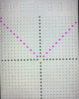 Feelif Graph-app met zwart assenstelsel en een getekende wiskundige vergelijking als paarse lijn in een v-vorm met de punt van de V op de oosprong van het stelsel.
